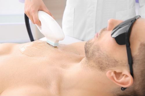Permanent full body laser hair removal for men in Toronto  VS MedSpa