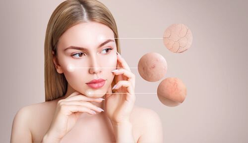 How to Tell the Difference Between Acne vs Rosacea